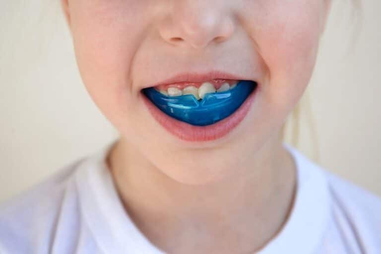 Why Mouthguards are Important in Sports