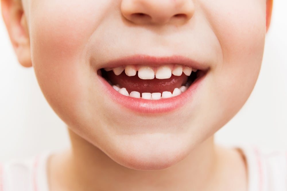 4 Effective Strategies to Prevent Early Tooth Decay in Toddlers