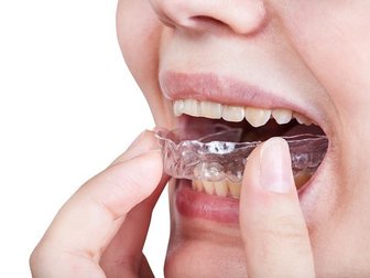 Here’s Everything about Teeth Grinding and Treatment for the Same