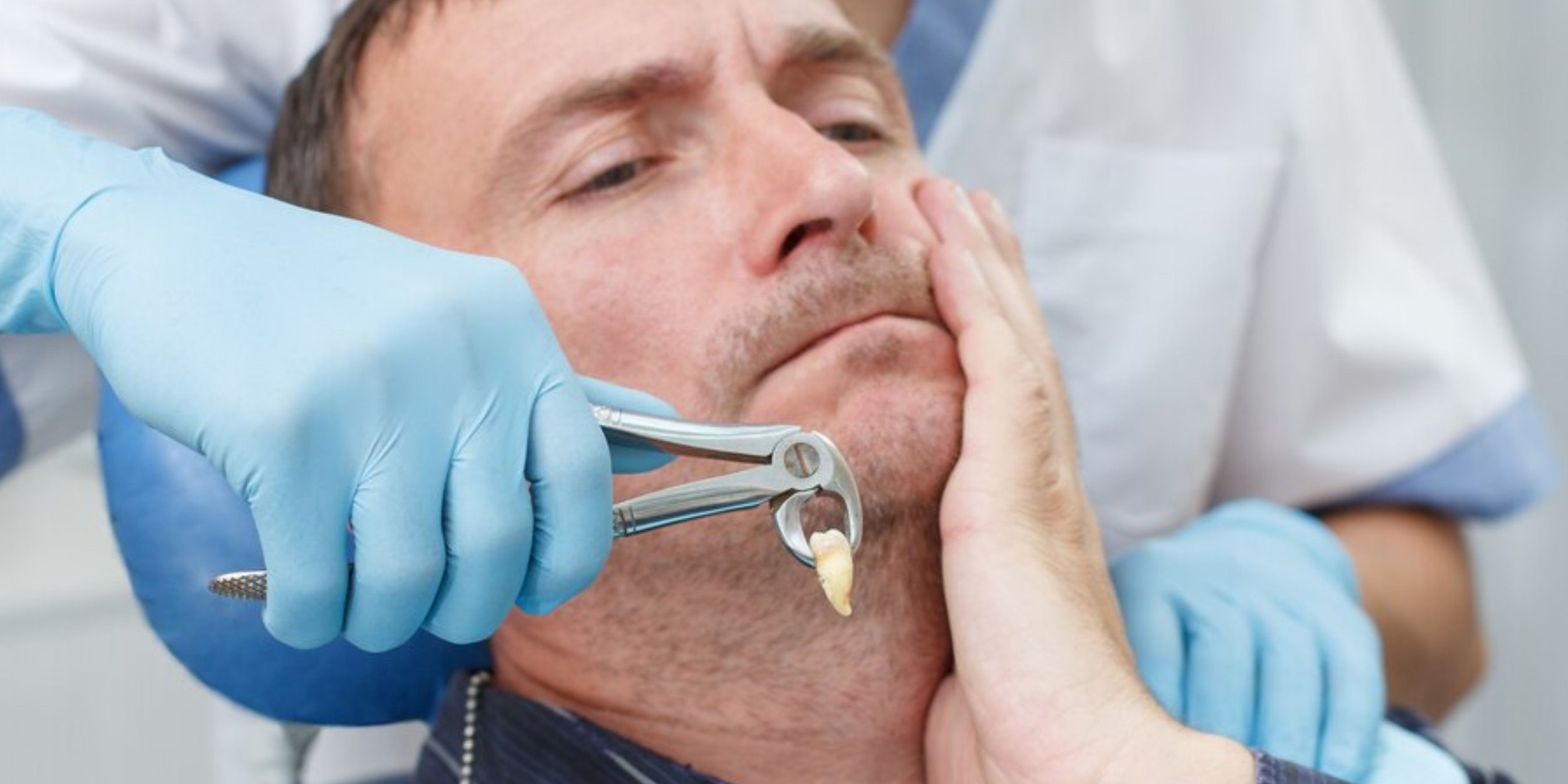 Clear Symptoms That Signal You Need a Tooth Extractio