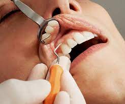 How Oral Surgery and Cosmetic Dentistry Benefits Individuals